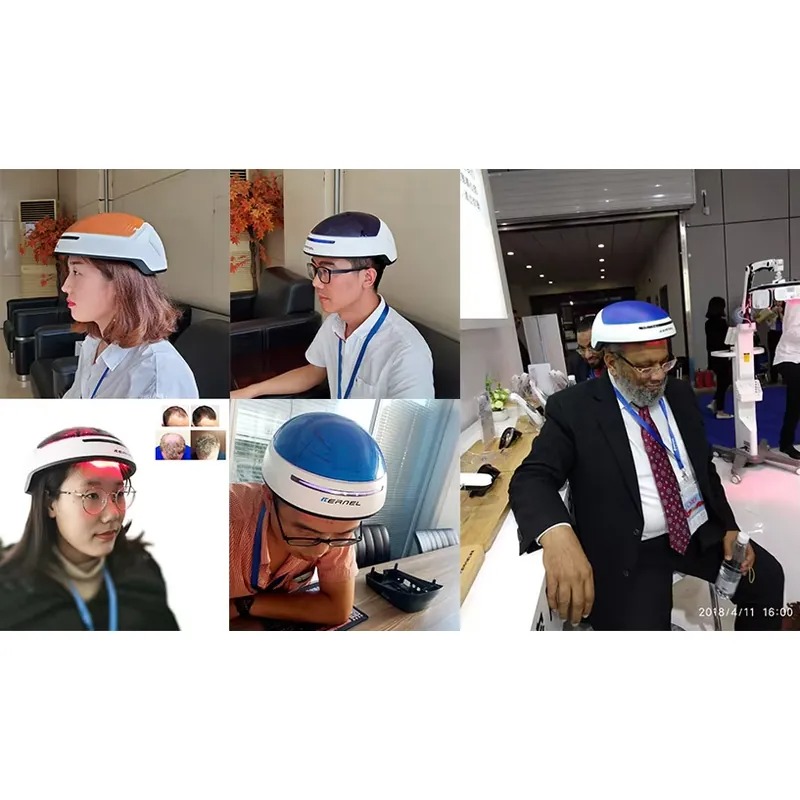 Casco de Terapia Capilar de Ba - Men Accessories App reseña y precio